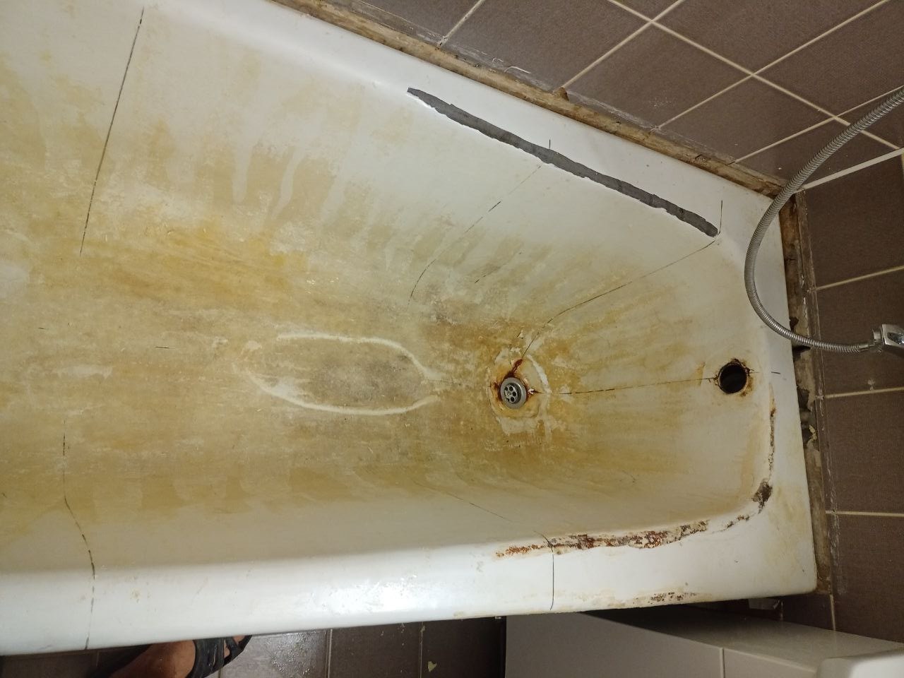 До реставрации: Сильный износ эмали